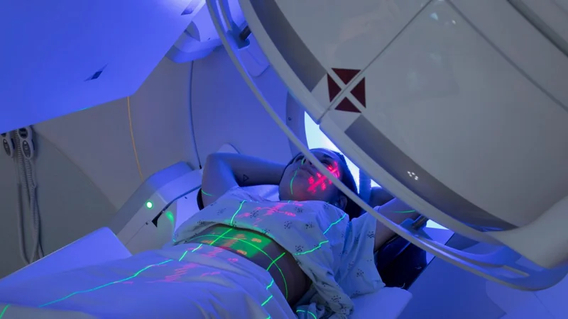 Radioterapia moderna: menos miedo, más precisión