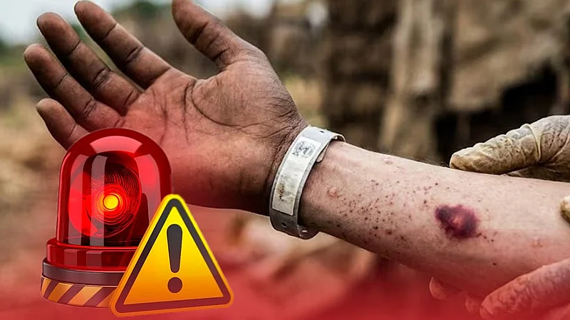 ¡Alerta preventiva por ébola! Ministerio de Salud fortalece vigilancia