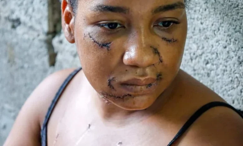 Barahona se solidariza con Nayely Capellán: 26 estocadas en La Vega encienden alarmas sobre la violencia de género en el Sur