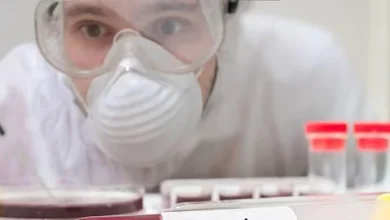 Salud Pública refuerza vigilancia preventiva por ántrax: no hay casos en el país