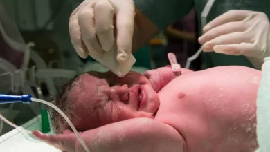 Especialista explica cuándo el parto vaginal es lo indicado y cuándo la cesárea es necesaria
