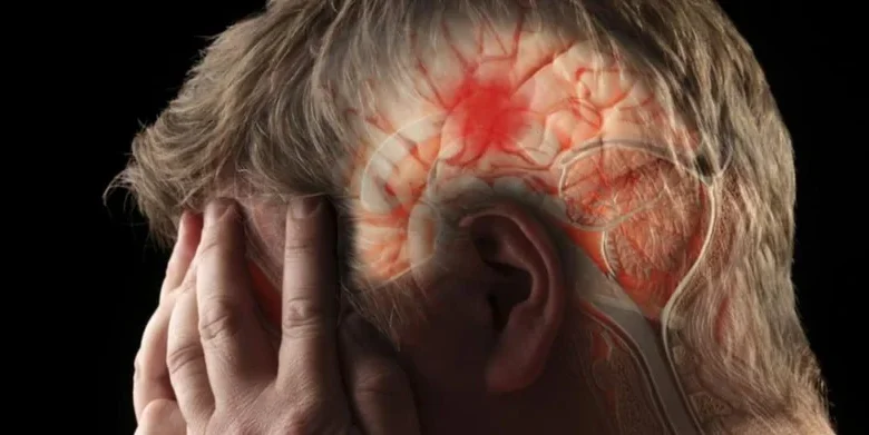 Sociedad de Neurología pide al país mayor respuesta frente a los ACV