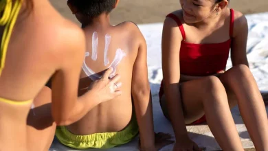 Dermatóloga alerta sobre errores comunes que agravan afecciones de la piel en niños por el calor