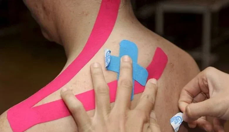 Kinesiotaping: alivio pasajero y evidencia débil, según estudio con 310 ensayos