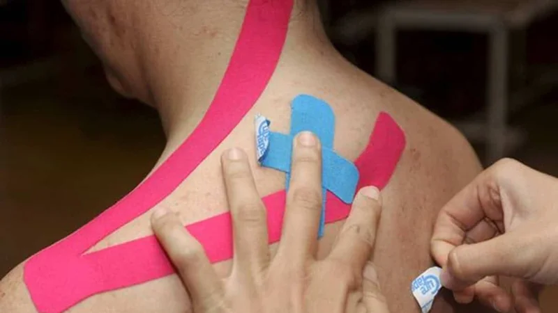 Kinesiotaping: alivio pasajero y evidencia débil, según estudio con 310 ensayos