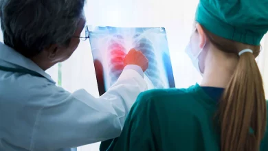 Diagnóstico temprano del cáncer de pulmón: lo que debe saber para cuidar su salud