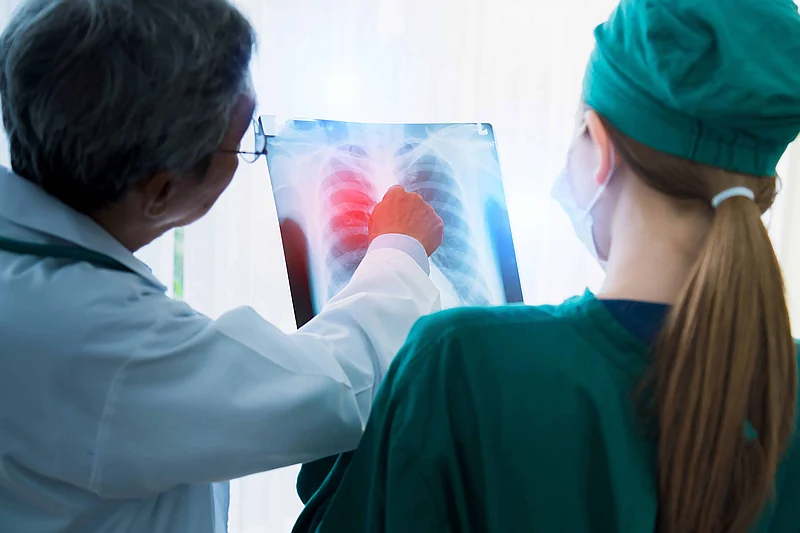 Diagnóstico temprano del cáncer de pulmón: lo que debe saber para cuidar su salud