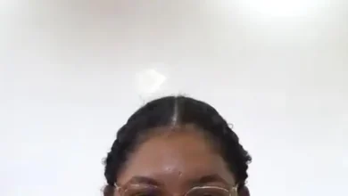 Dominicana de 23 años pide ayuda para tratar tumor en su ojo izquierdo