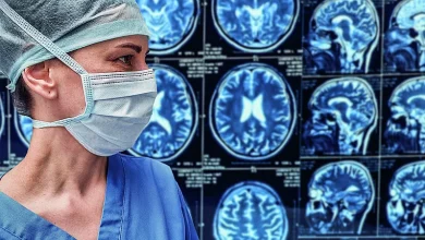 Cada 40 segundos, un ACV en el mundo: cómo reconocer los síntomas y actuar a tiempo